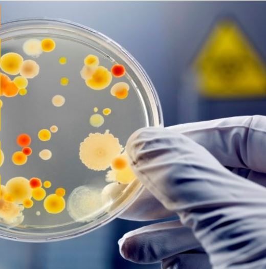 Guante sujetando una placa de Petri con muestras microbióticas 