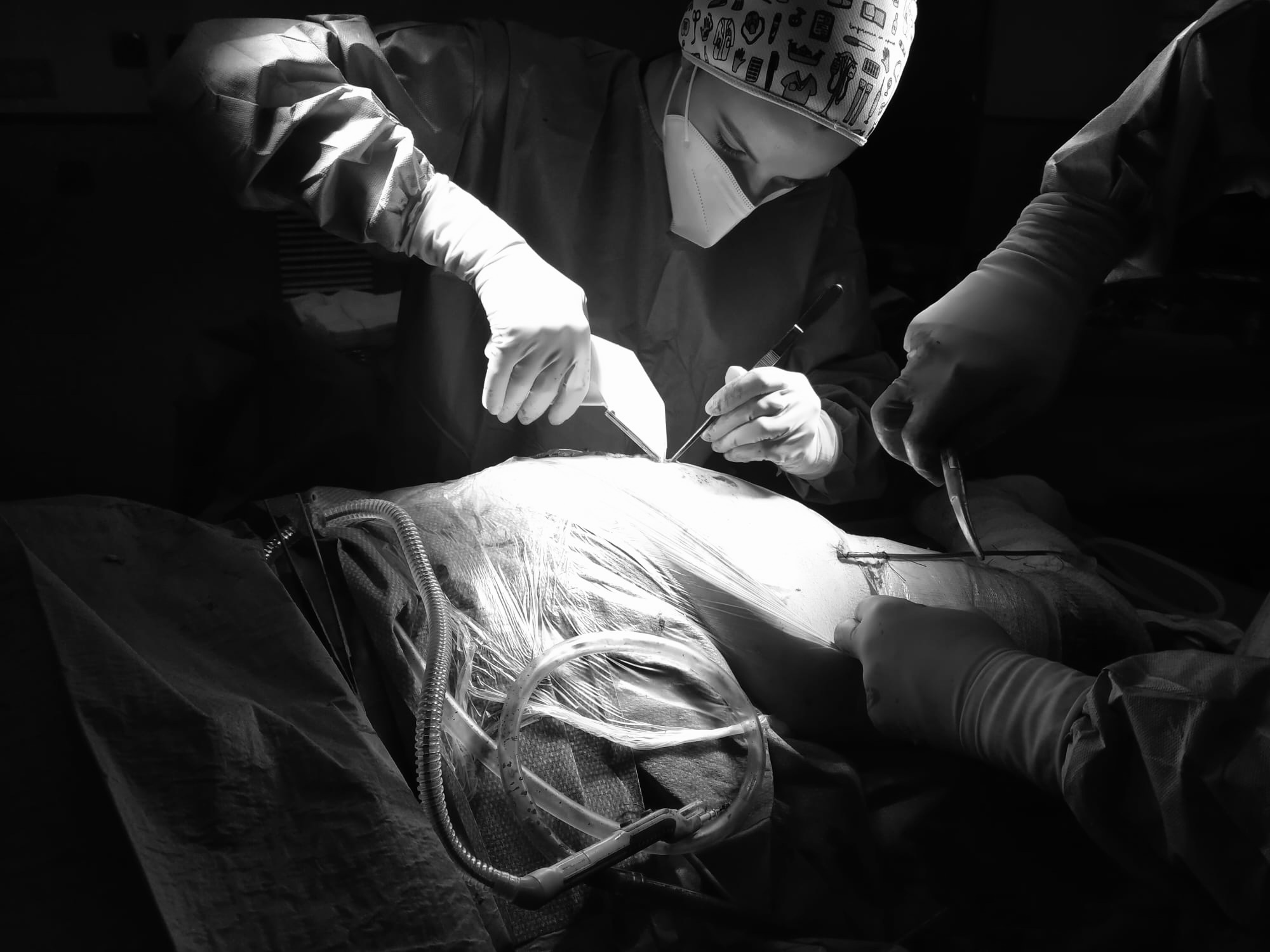 Cirurgiana realitzant una laparoscòpia a un pacient 
